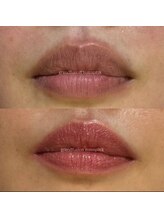 リュミエール デスポワール(Lumiere d'espoir)/ROMAPINK ローマピンク