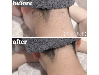 ライチェンド(Reizend)の写真/【都度払い/コース契約なし】お肌に優しい脱毛で、気になるムダ毛のお悩みを改善します。全身脱毛可能◎