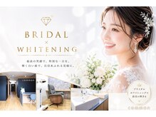 セルフホワイトニングコモン 藤枝店(self whitening common)の雰囲気（【歯科提携ジェル使用】ブライダルメニューも充実しています◎）