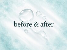モアナ(MOANA)/before & after