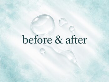 モアナ(MOANA)/before & after