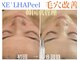 ロージースマイル(Rosy smile)の写真