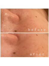 メナードフェイシャルサロン 岐阜茜部/ブライダルエステ/美肌/透明感