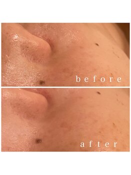 メナードフェイシャルサロン 岐阜茜部/ブライダルエステ/美肌/透明感