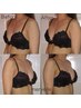 【大き目バスト/3回体験】下垂・外向き・離れを整え理想の美乳ラインへ！