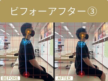 幕張南口整骨院/ビフォーアフター３