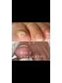 ネイルズレイ(Nails Ray)&nbsp;巻爪、割れ爪のお悩みや様々な爪のトラブルもご相談ください^_^