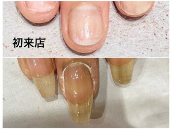 グレースレディ/憧れのロングネイルへー