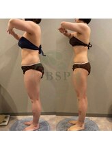 エステティックサロン ピュール ボーテ 東金店/食べて痩せる健康ダイエット