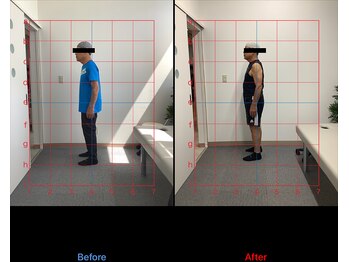 リード整骨院(LEAD整骨院)/ゴルフによる腰痛、背中の痛み