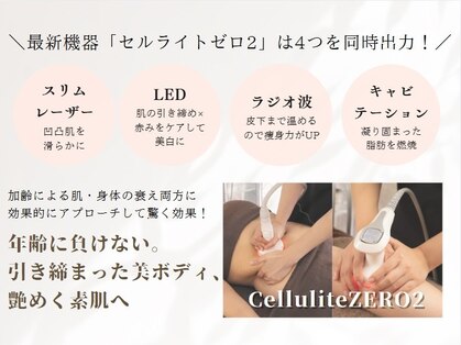 ヴィッソの写真