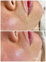 フェイス(Faith)/お顔シュガーリング