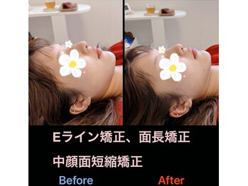 美容矯正サロン レレポノ(LELEPONO)/