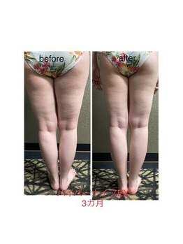 チュラ/ハイパーナイフ【所沢/秋津】