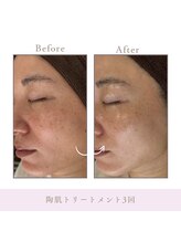 サロン アンジュ(salon.anju)/