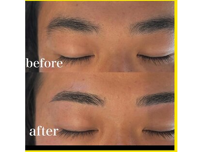 ノル(NOLU)の写真