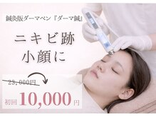 はる鍼灸整骨院