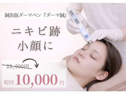 はる鍼灸整骨院の写真