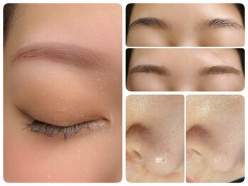 トータルビューティ ノイド(Noid)/小鼻コース+美眉毛WAX脱毛