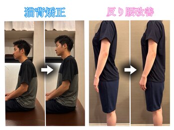 こころ整骨院の写真/【全スタッフ国家資格保有！】急な痛みや慢性的な腰痛、どこへ行っても改善しない肩こり頭痛もお任せ！