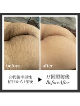 エリクサー 加須店(Elixir)/しっかりした毛も1年でキレイ◎