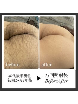 エリクサー 加須店(Elixir)/しっかりした毛も1年でキレイ◎