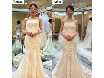 コルミチョン サロン(骨美整 salon)/ブライダル施術　Before・After