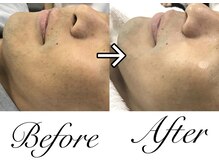 マリア(MARIA)/メンズフェイシャル