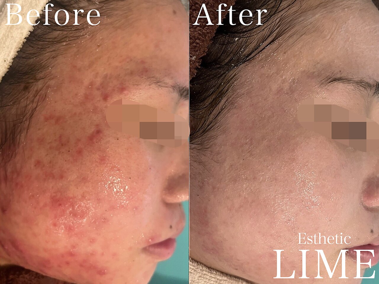 ライム 武庫之荘(LIME)｜ホットペッパービューティー