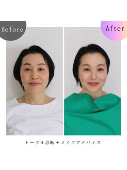 シュアリー(Surely)/トータルコースお客様事例