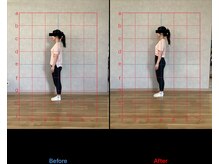 リード整骨院(LEAD整骨院)/ピラティスで姿勢改善。#反り腰