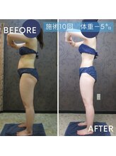 ヴィオテラス(VIOTERACE)/３ヶ月集中ダイエット☆