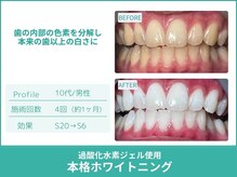 クレア(Crea)の雰囲気（短期間で第一印象が大きく変わる本格ホワイトニング！）