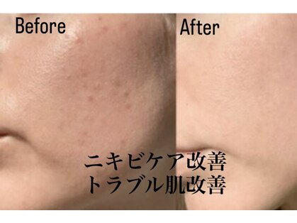 イリゼ(IRISE)の写真