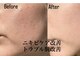 イリゼ(IRISE)の写真