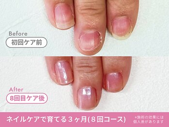 Before/After【feerie立川】