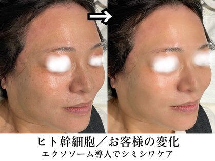 ビービーサロン 池袋(B.B salon)の写真