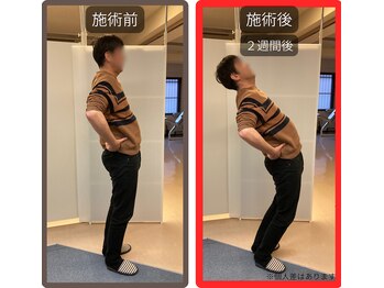 まこと整骨院/ぎっくりな腰でもこれだけ変化１