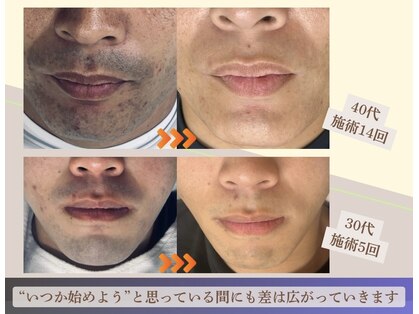 フォー(the 4)の写真