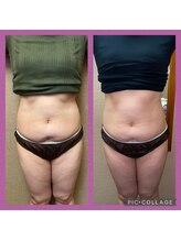 ビユ 大泉店(BIYU)/