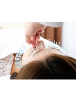 鍼灸施術を受けたい