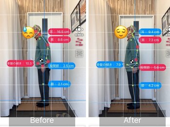 ナオル整体 札幌院(NAORU整体)/札幌円山/整体/姿勢矯正/猫背