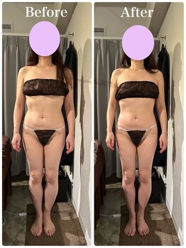 ハリムーン 仙台(harimoon)/120分美バストビフォーアフター