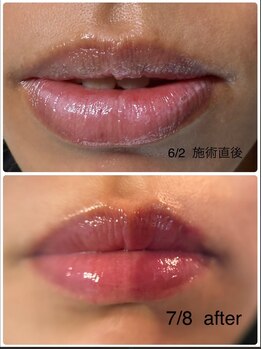 リュミエール デスポワール(Lumiere d'espoir)/ROMAPINK ローマピンク