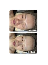 エクラ(ECLAT)/レストセルトリートメント