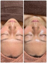 シャナ(Shana)/ラミネーションピール