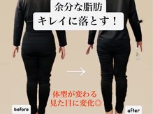 ヨサパーク リヴェラ 天王寺 阿倍野(YOSAPARK RIVELA)