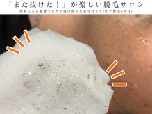 ボス 大曽根店(BOSS)の雰囲気（メンズ脱毛好実績！#メンズ脱毛#ヒゲ脱毛#VIO脱毛#眉毛#全身脱毛）