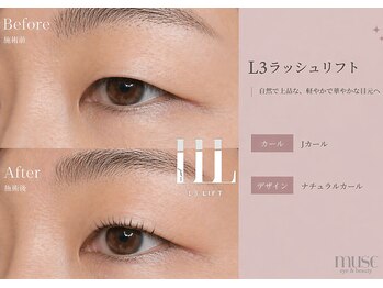 ミューズ(MUSE)/Before/After:L3リフト