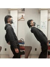 とるこり美姿整体院 新宿院/20代男性-腰痛改善Before/After